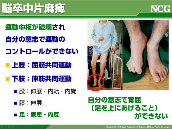 義肢装具士　オープンキャンパス　日本聴能言語福祉学院